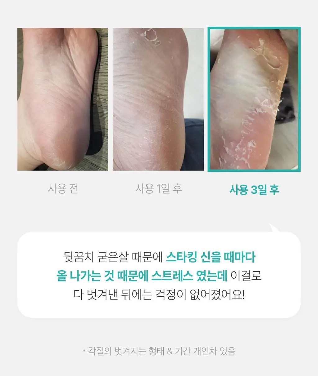 [발허물팩] 아리얼 스무스 앤 퓨어 풋 필링 마스크 2입 7종 택1 상세페이지 15